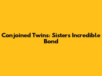 Conjoined Twins: Sisters' Incredible Bond