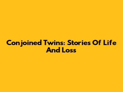 Conjoined Twins: Stories Of Life And Loss