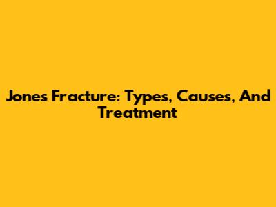 Jones Fracture: Types, Causes, And Treatment
