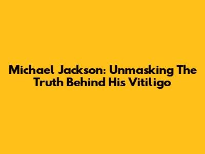 Michael Jackson: Unmasking The Truth Behind His Vitiligo