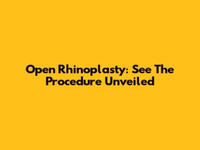 Open Rhinoplasty: See The Procedure Unveiled