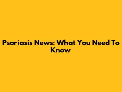 Psoriasis News: What You Need To Know