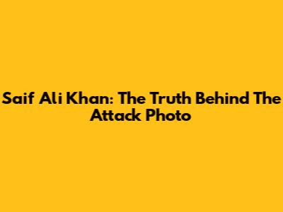 Saif Ali Khan: The Truth Behind The Attack Photo