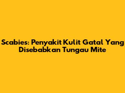 Scabies: Penyakit Kulit Gatal Yang Disebabkan Tungau Mite