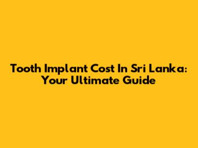 Tooth Implant Cost In Sri Lanka: Your Ultimate Guide